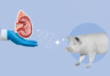 Historic Pig Kidney Transplant Achieves 271 Day Milestone